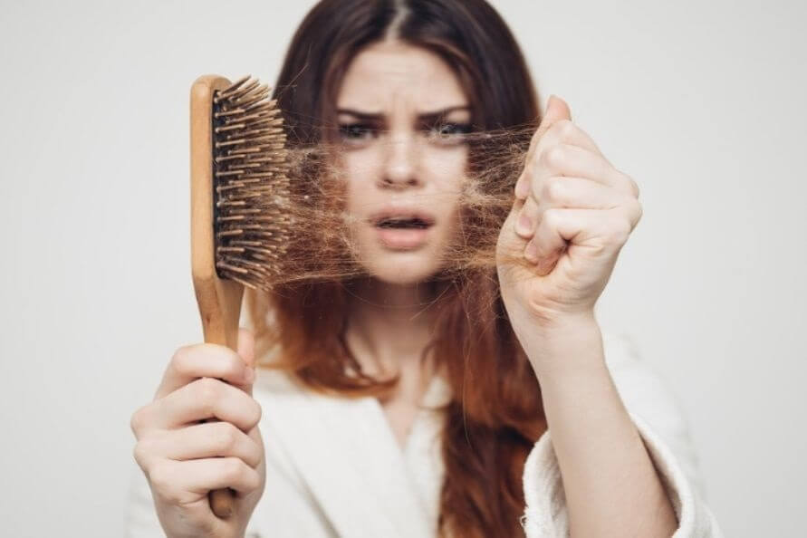 طاسی و ریزش مو
